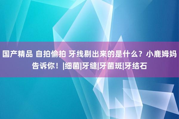 国产精品 自拍偷拍 牙线剔出来的是什么？小鹿姆妈告诉你！|细菌|牙缝|牙菌斑|牙结石